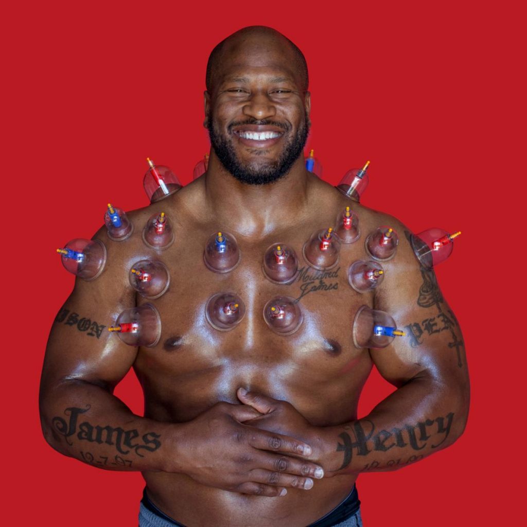 James Harrison