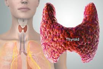 3900-thyroid-profile-181