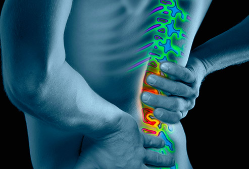 low back pain