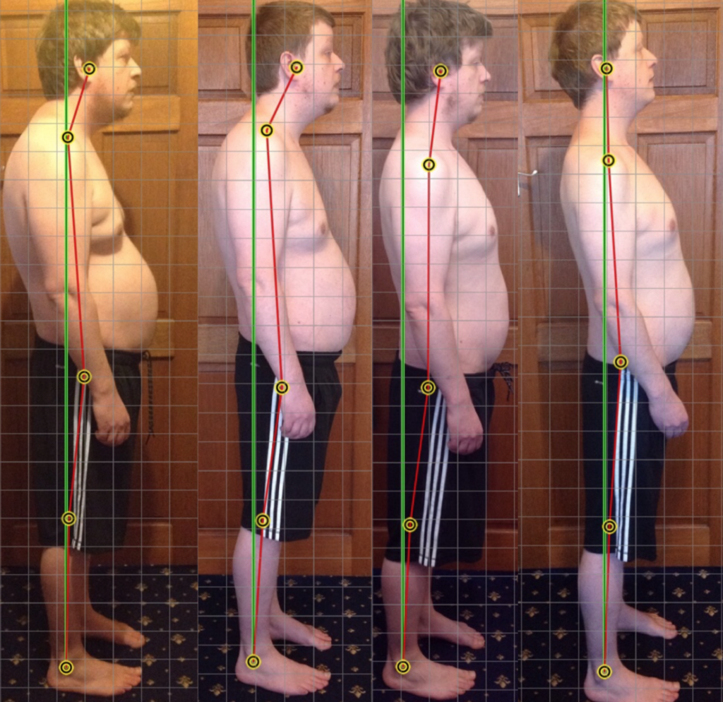 Correcting American Posture